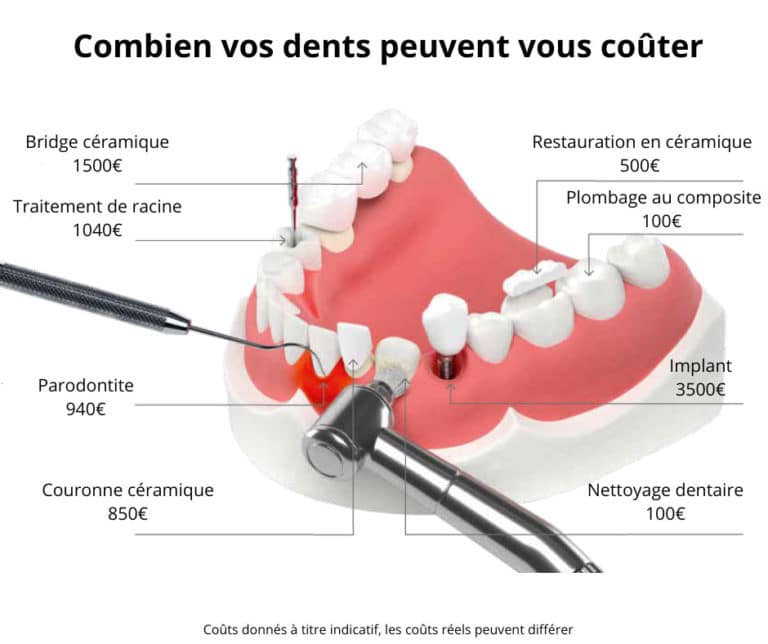 Combien vos dents peuvent vous couter en Allemagne ?